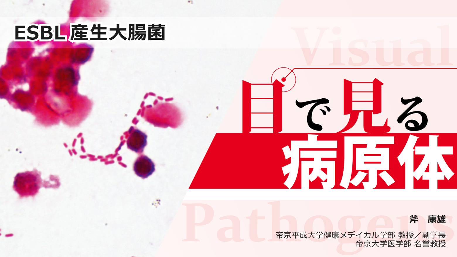 目で見る病原体 ⑩ESBL産生大腸菌 | 感染対策Online